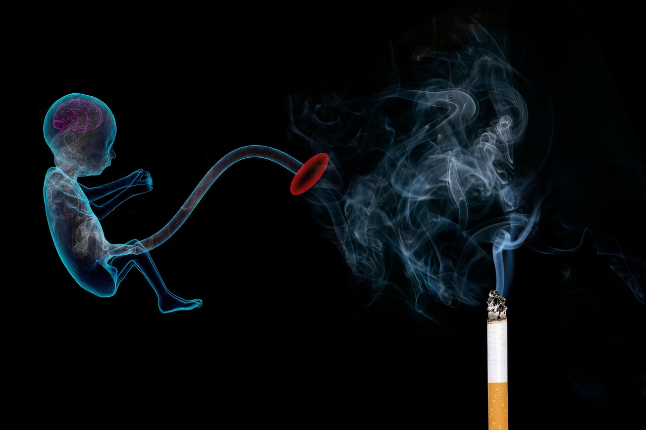 태아보험다이렉트 설계